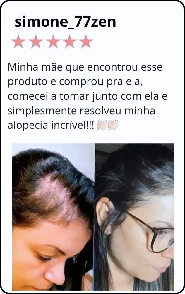 Subnatbio – Suplemento Natural para Cabelos e Unhas