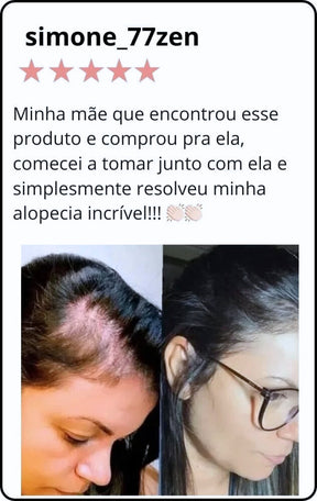 Subnatbio – Suplemento Natural para Cabelos e Unhas