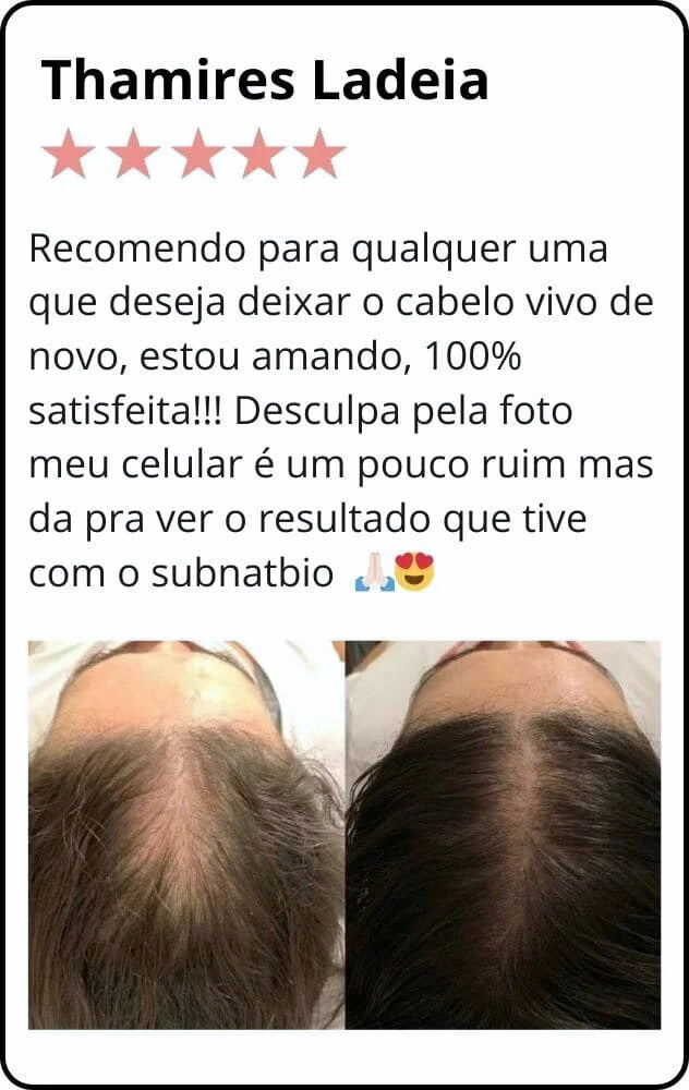 Subnatbio – Suplemento Natural para Cabelos e Unhas